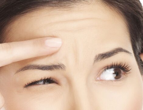 Woman pointing to reduced fine lines on her forehead where she's getting Botox injectables