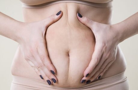 woman squeezing her stomach