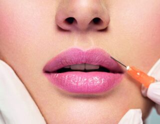 doctor inserting lip fillers into woman's lips