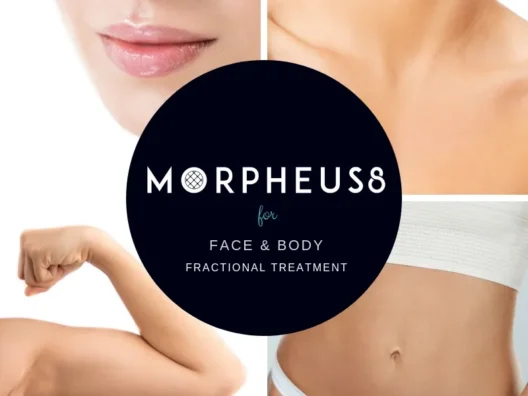 morpehus8 for face and body fractional treatment